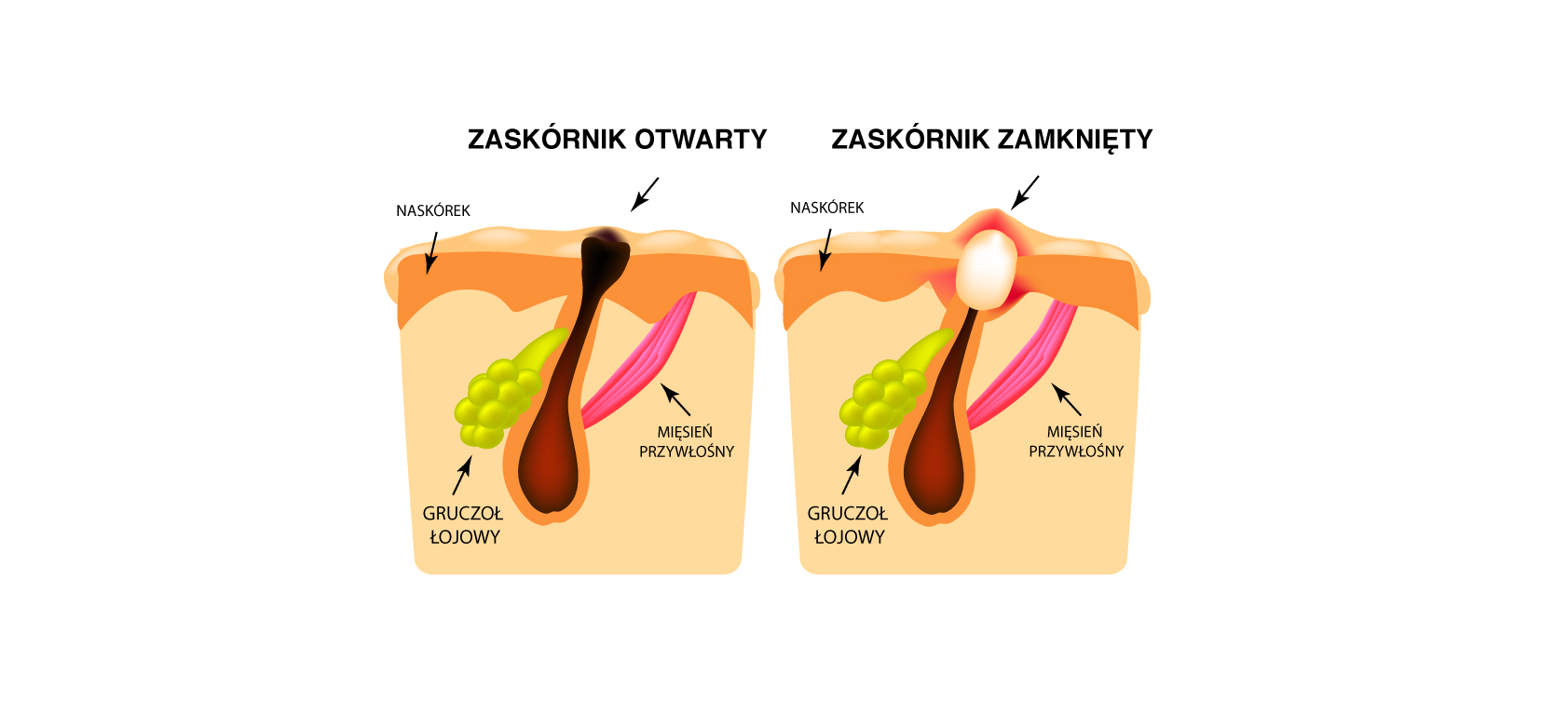 zaskórniki