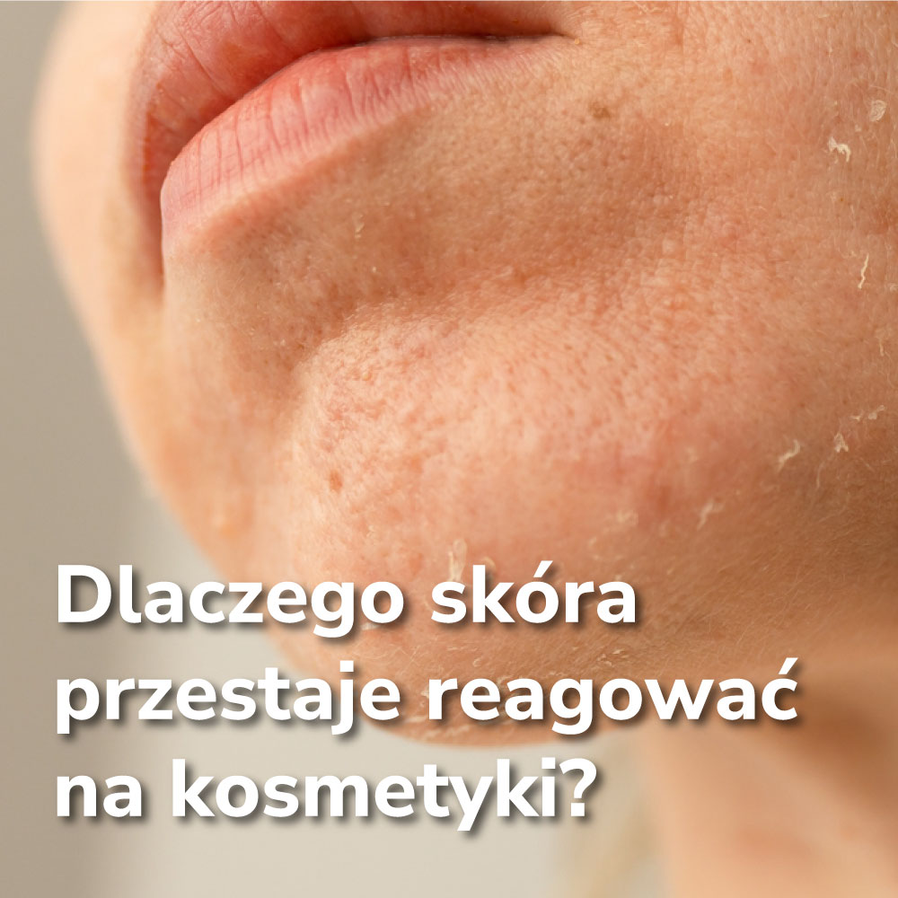 Dlaczego skóra przestaje reagować na kosmetyki? Objawy, przyczyny i co z tym zrobić