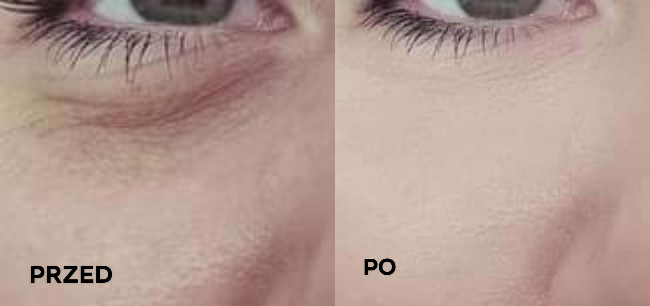 Pielęgnacja skóry pod oczami